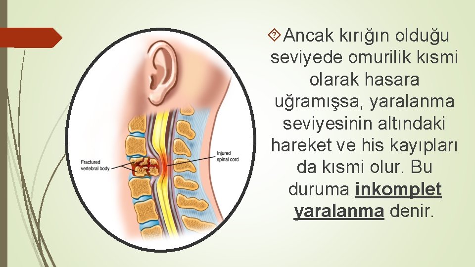  Ancak kırığın olduğu seviyede omurilik kısmi olarak hasara uğramışsa, yaralanma seviyesinin altındaki hareket