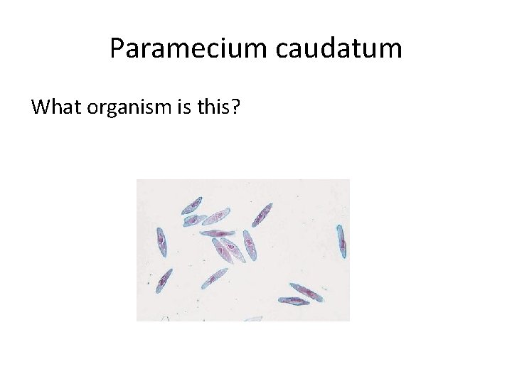 Paramecium caudatum What organism is this? 