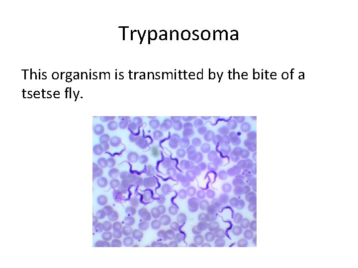 Trypanosoma This organism is transmitted by the bite of a tsetse fly. 