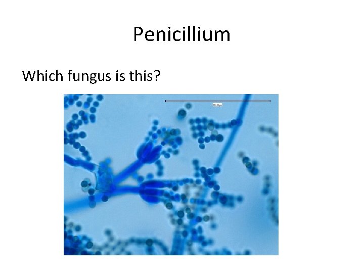 Penicillium Which fungus is this? 