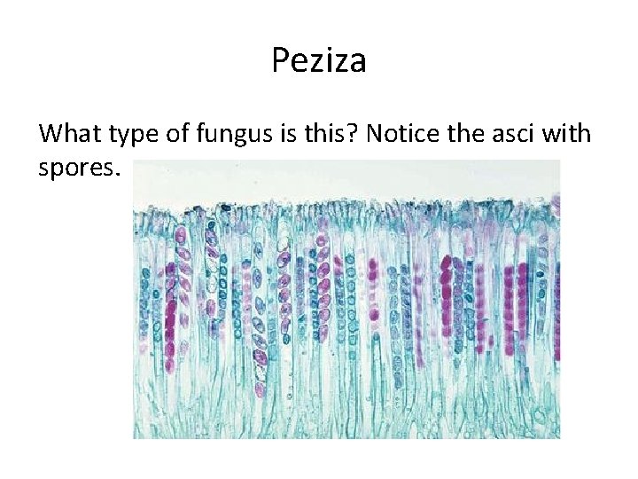 Peziza What type of fungus is this? Notice the asci with spores. 