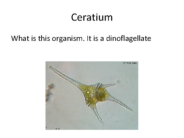 Ceratium What is this organism. It is a dinoflagellate 