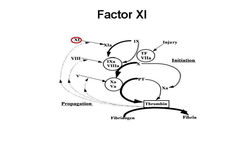 Factor XI 