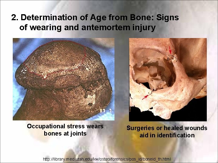 2. Determination of Age from Bone: Signs of wearing and antemortem injury Occupational stress