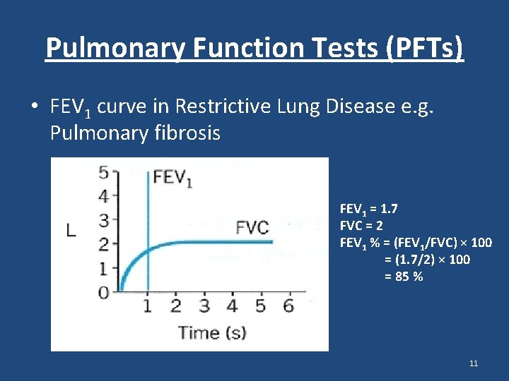 Pulmonary Function Tests (PFTs) • FEV 1 curve in Restrictive Lung Disease e. g. Pulmonary Function Tests (PFTs) • FEV 1 curve in Restrictive Lung Disease e. g.