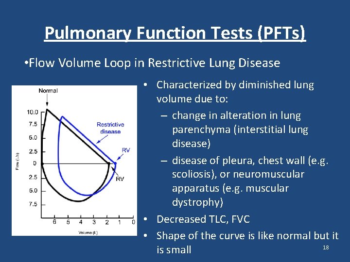 Pulmonary Function Tests (PFTs) • Flow Volume Loop in Restrictive Lung Disease • Characterized Pulmonary Function Tests (PFTs) • Flow Volume Loop in Restrictive Lung Disease • Characterized