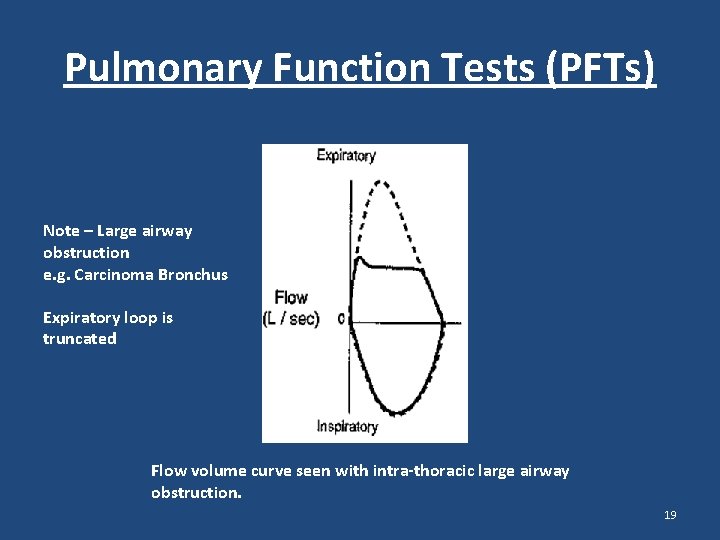 Pulmonary Function Tests (PFTs) Note – Large airway obstruction e. g. Carcinoma Bronchus Expiratory Pulmonary Function Tests (PFTs) Note – Large airway obstruction e. g. Carcinoma Bronchus Expiratory