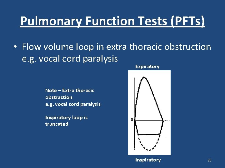 Pulmonary Function Tests (PFTs) • Flow volume loop in extra thoracic obstruction e. g. Pulmonary Function Tests (PFTs) • Flow volume loop in extra thoracic obstruction e. g.