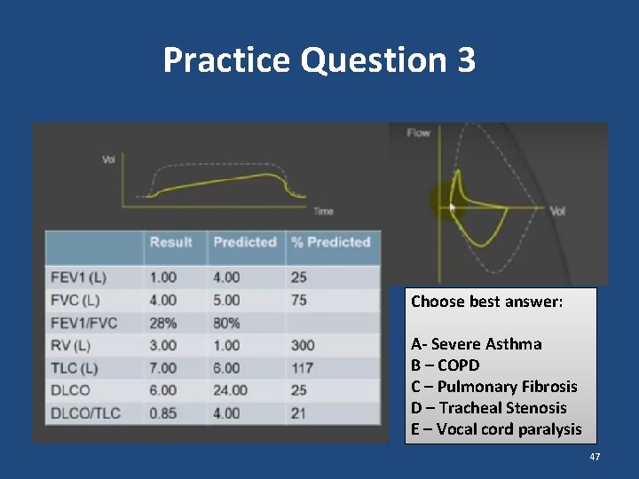 Practice Question 3 Choose best answer: A- Severe Asthma B – COPD C – Practice Question 3 Choose best answer: A- Severe Asthma B – COPD C –