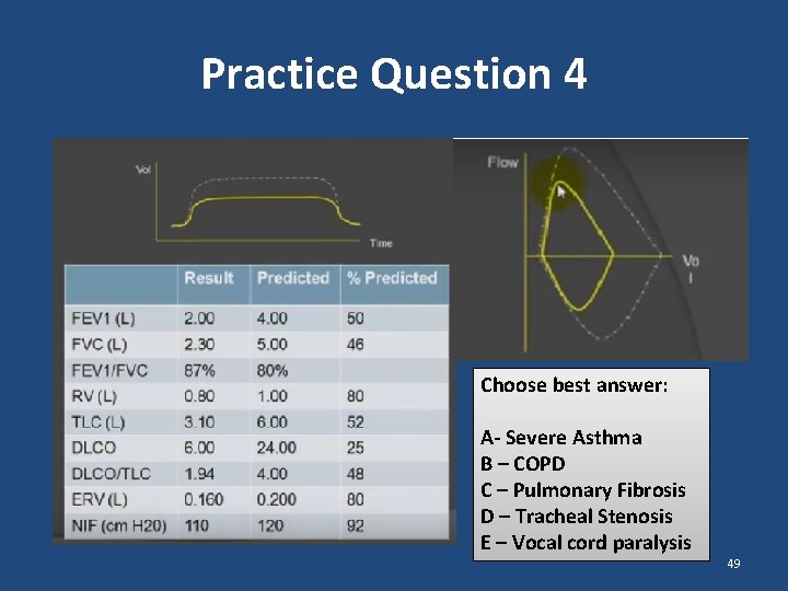 Practice Question 4 Choose best answer: A- Severe Asthma B – COPD C – Practice Question 4 Choose best answer: A- Severe Asthma B – COPD C –