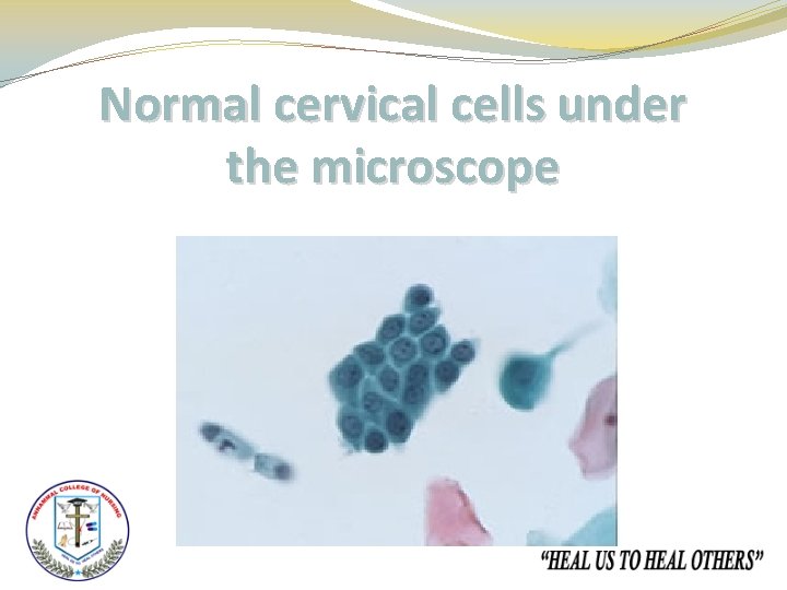 Normal cervical cells under the microscope 