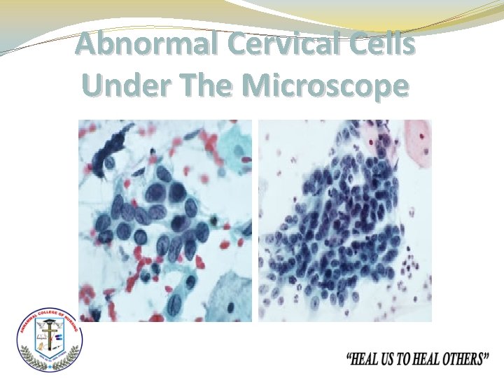 Abnormal Cervical Cells Under The Microscope 