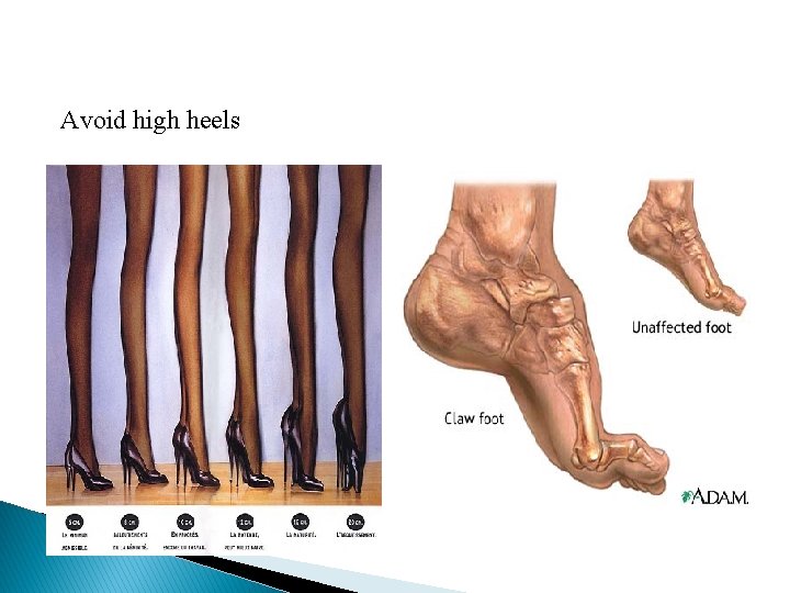 Avoid high heels 