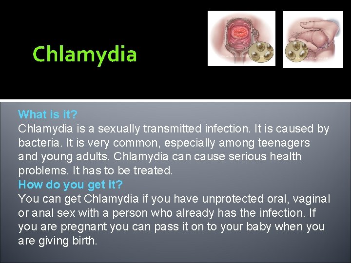Chlamydia What is it? Chlamydia is a sexually transmitted infection. It is caused by