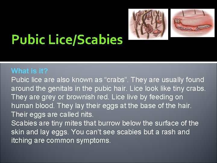 Pubic Lice/Scabies What is it? Pubic lice are also known as “crabs”. They are