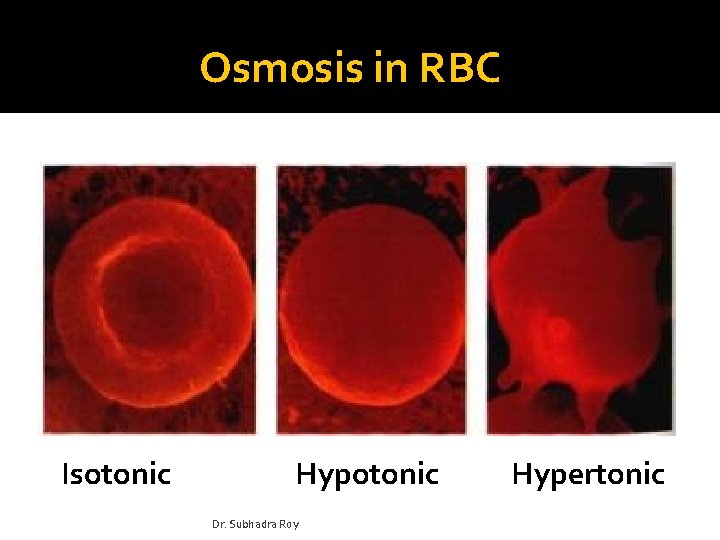 Osmosis in RBC Isotonic Hypotonic Dr. Subhadra Roy Hypertonic 