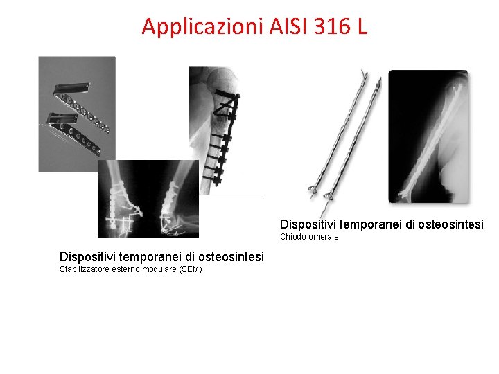 Applicazioni AISI 316 L Dispositivi temporanei di osteosintesi Chiodo omerale Dispositivi temporanei di osteosintesi