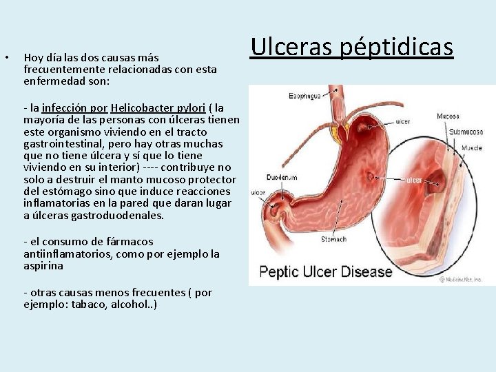  • Hoy día las dos causas más frecuentemente relacionadas con esta enfermedad son: