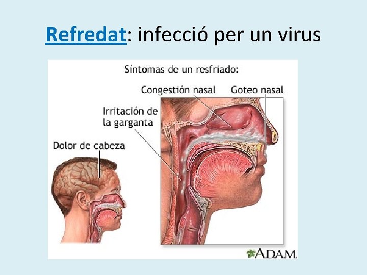 Refredat: infecció per un virus Refredat: infecció per un virus