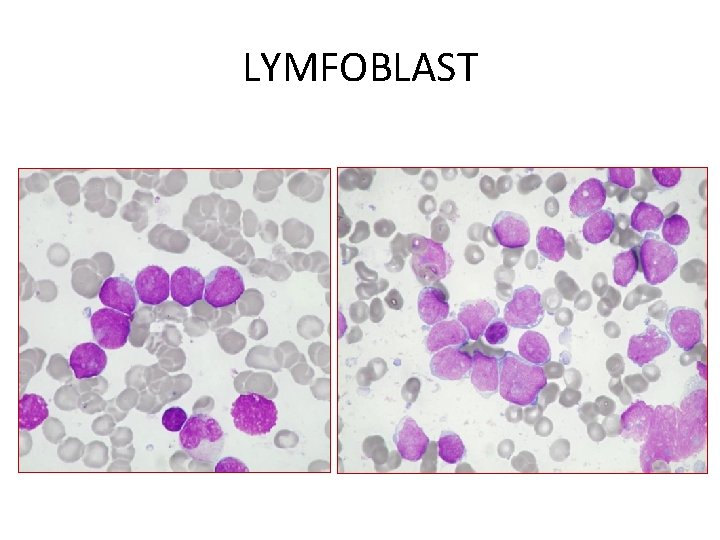 LYMFOBLAST 