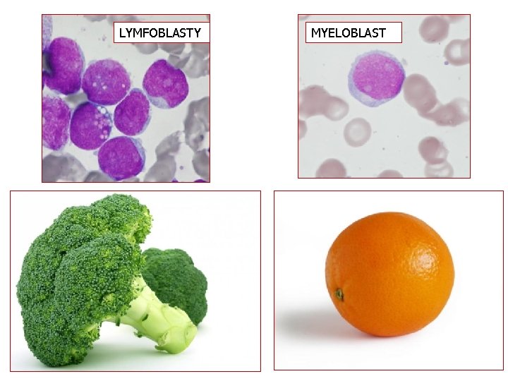 LYMFOBLASTY MYELOBLAST 