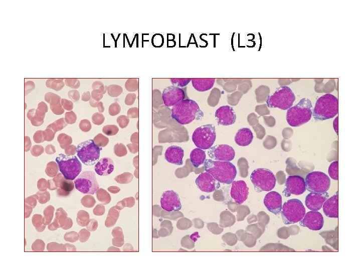 LYMFOBLAST (L 3) 