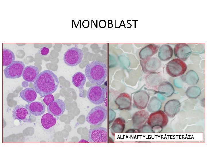 MONOBLAST ALFA-NAFTYLBUTYRÁTESTERÁZA 