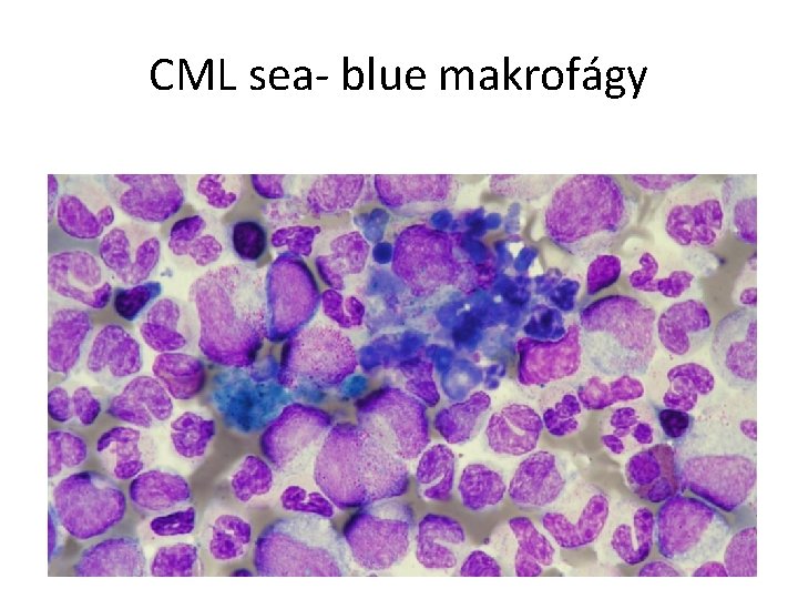 CML sea- blue makrofágy 