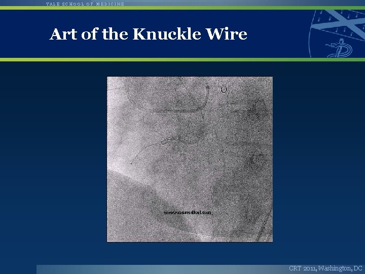 YALE SCHOOL OF MEDICINE Art of the Knuckle Wire CRT 2011, Washington, DC 