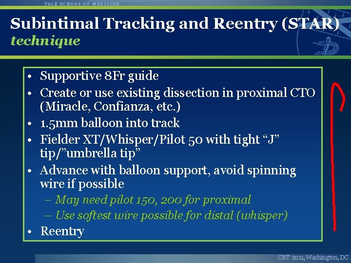 YALE SCHOOL OF MEDICINE Subintimal Tracking and Reentry (STAR) technique • Supportive 8 Fr