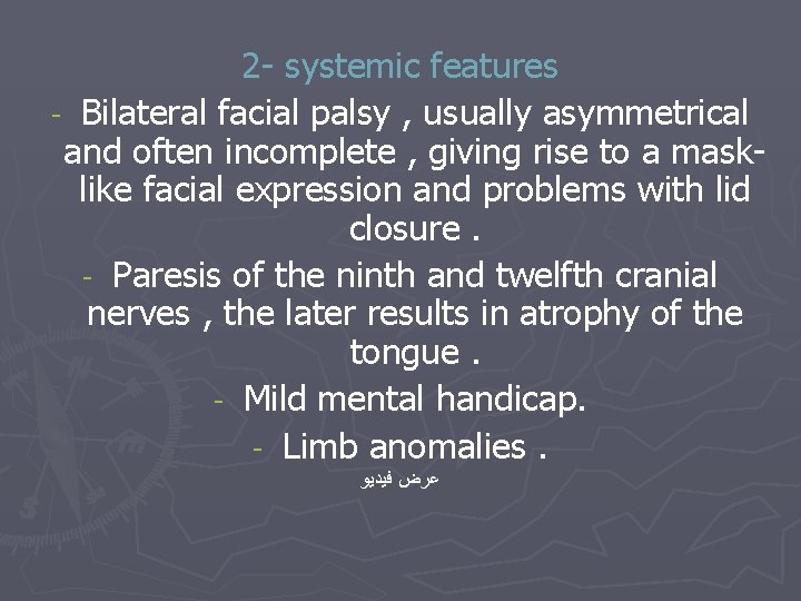 2 - systemic features - Bilateral facial palsy , usually asymmetrical and often incomplete