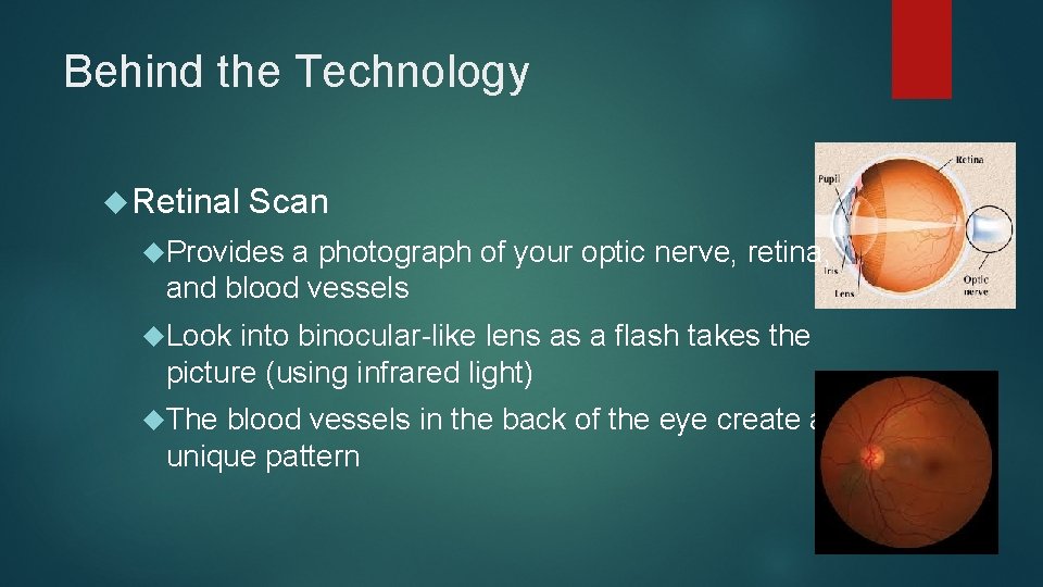 Behind the Technology Retinal Scan Provides a photograph of your optic nerve, retina, and