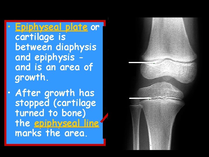 • Epiphyseal plate or cartilage is between diaphysis and epiphysis and is an