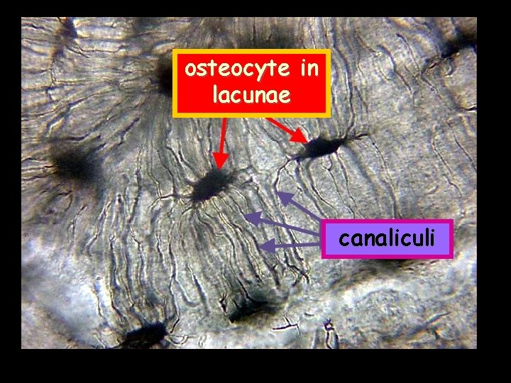osteocyte in lacunae canaliculi 