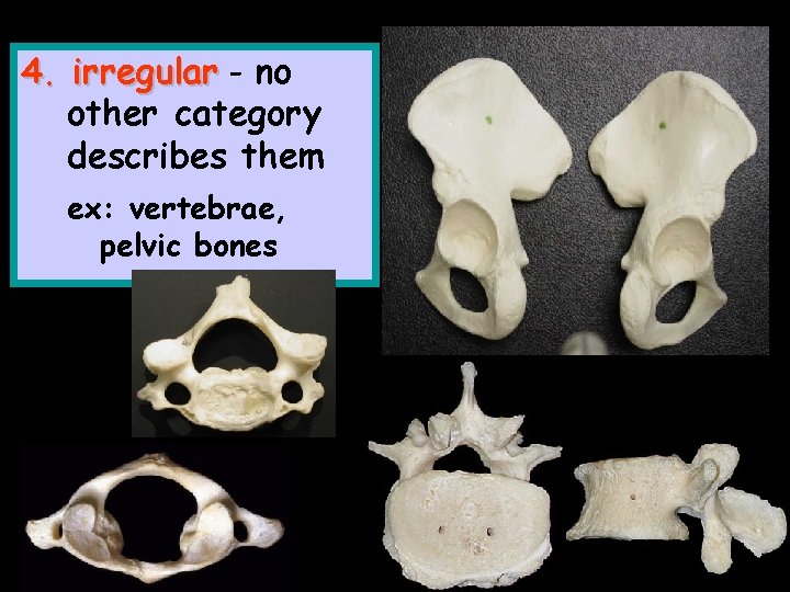 4. irregular - no other category describes them ex: vertebrae, pelvic bones 