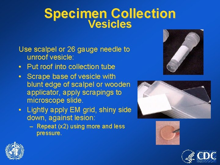 Specimen Collection Vesicles Use scalpel or 26 gauge needle to unroof vesicle: • Put