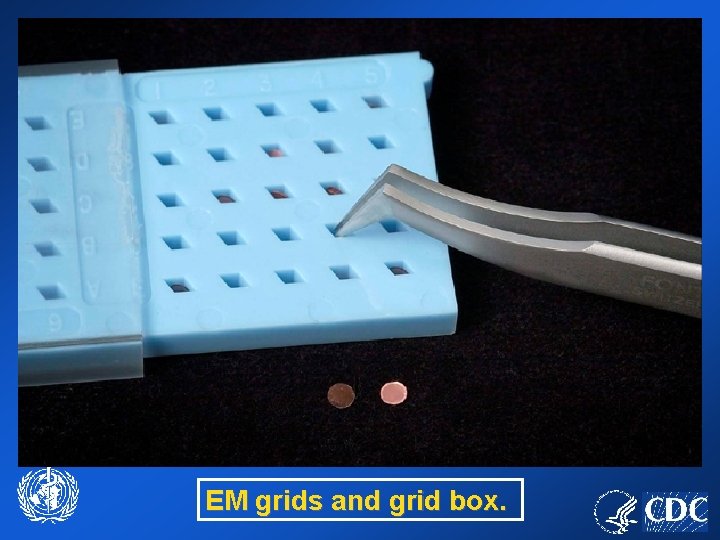 EM grids and grid box. 