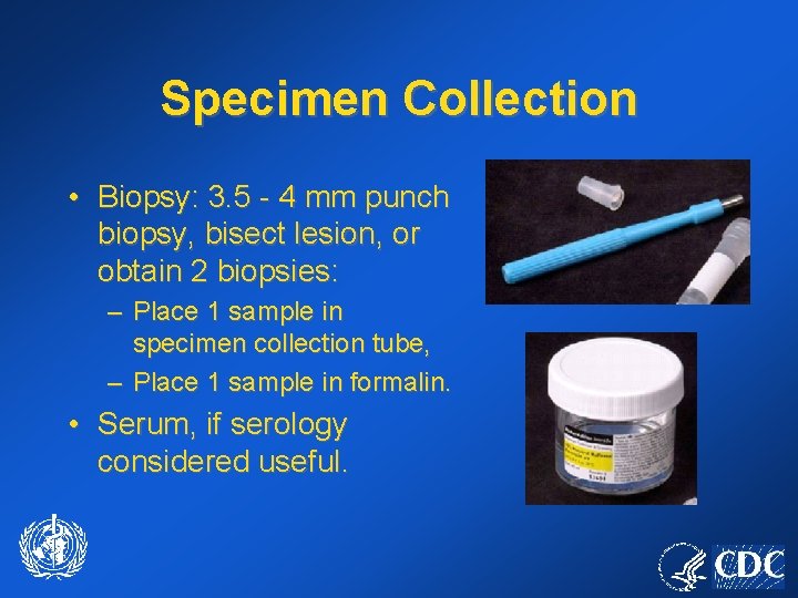 Specimen Collection • Biopsy: 3. 5 - 4 mm punch biopsy, bisect lesion, or