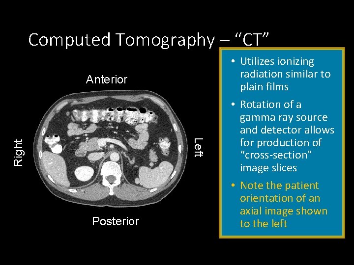 Computed Tomography – “CT” Anterior Right Left Posterior • Utilizes ionizing radiation similar to