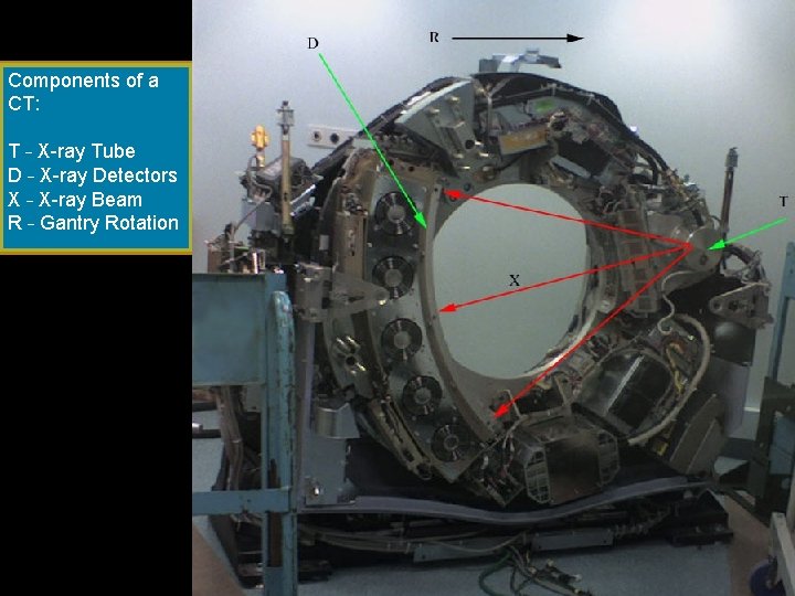 Components of a CT: T – X-ray Tube D – X-ray Detectors X –