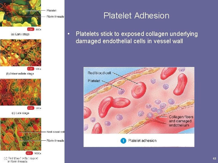 Platelet Adhesion • Platelets stick to exposed collagen underlying damaged endothelial cells in vessel