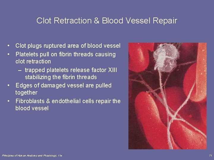 Clot Retraction & Blood Vessel Repair • Clot plugs ruptured area of blood vessel