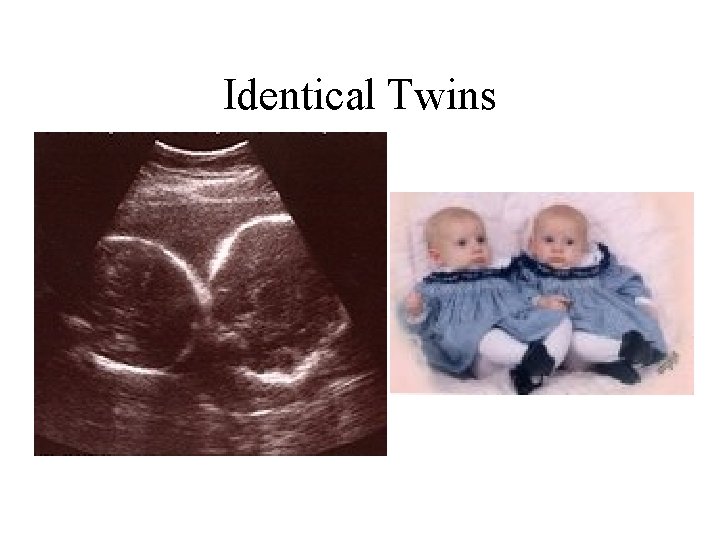 Identical Twins 