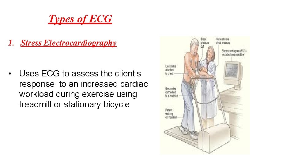 Types of ECG 1. Stress Electrocardiography • Uses ECG to assess the client’s response