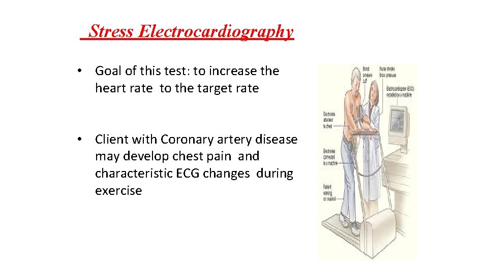 Stress Electrocardiography • Goal of this test: to increase the heart rate to the