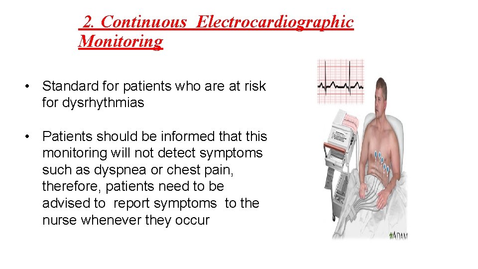 2. Continuous Electrocardiographic Monitoring • Standard for patients who are at risk for dysrhythmias
