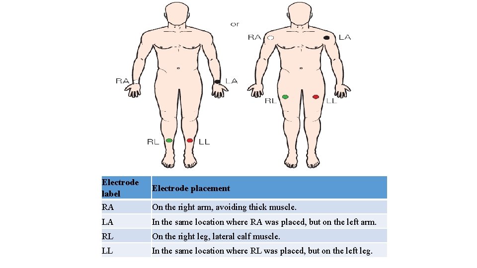 Electrode label RA Electrode placement On the right arm, avoiding thick muscle. LA In