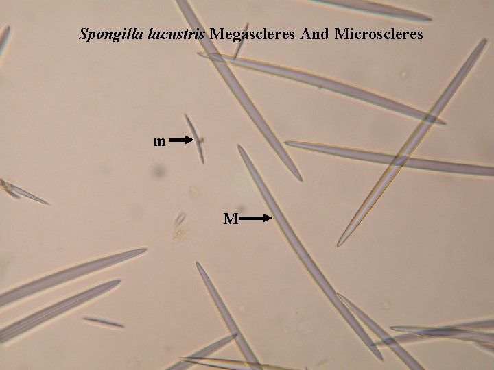Spongilla lacustris Megascleres And Microscleres m M 