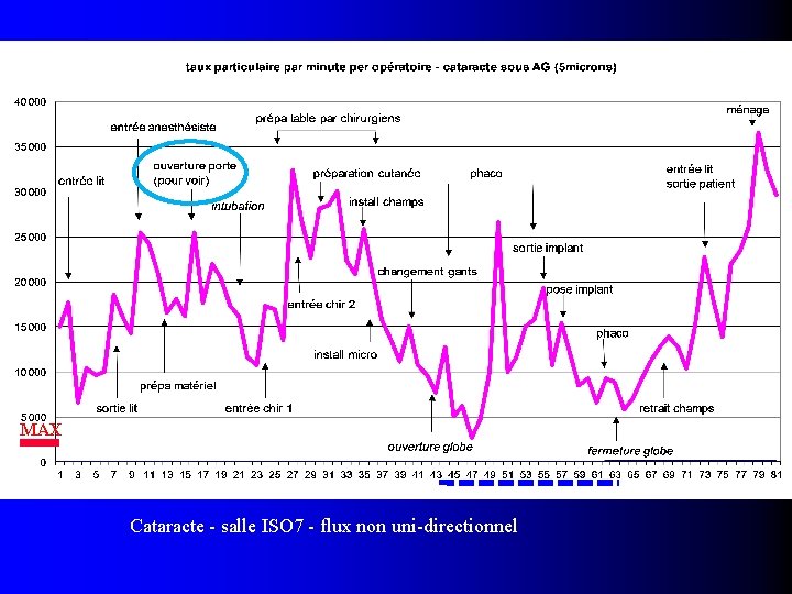 MAX Cataracte - salle ISO 7 - flux non uni-directionnel 