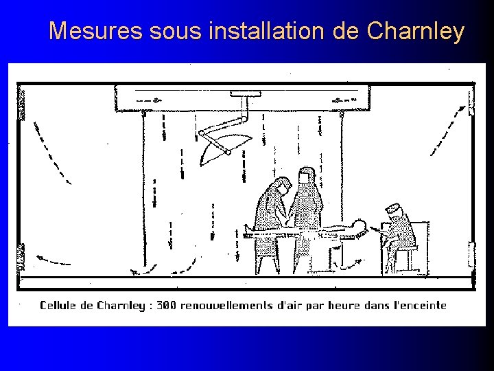 Mesures sous installation de Charnley 